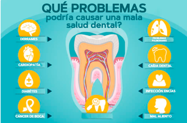 1 + 1 GRATIS | Blanqueador de dientes - TeethWhitenerPro™