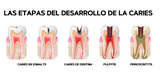 1 + 1 GRATIS | Blanqueador de dientes - TeethWhitenerPro™