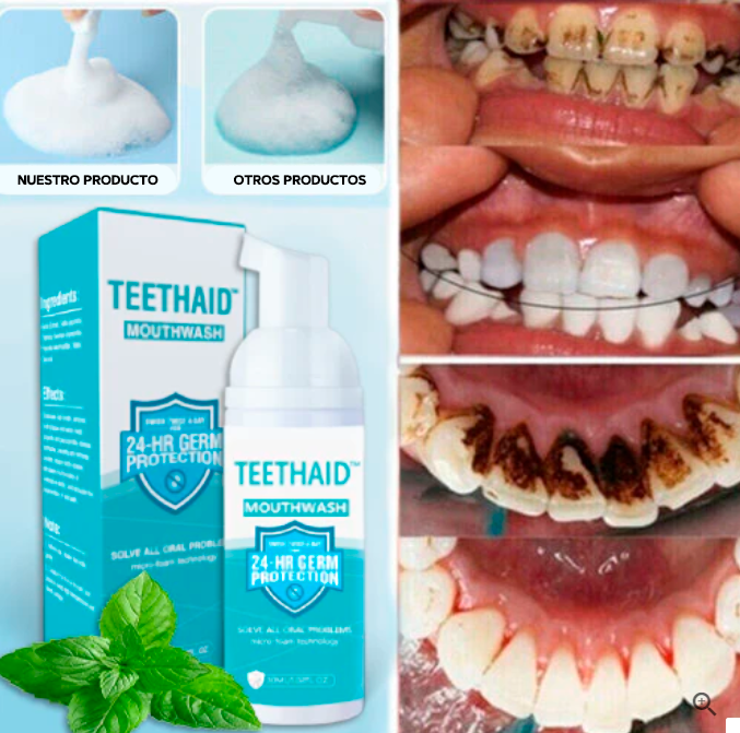 1 + 1 GRATIS | Blanqueador de dientes - TeethWhitenerPro™