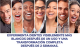 1 + 1 GRATIS | Blanqueador de dientes - TeethWhitenerPro™