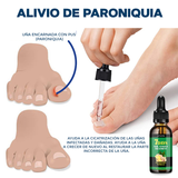 Aceite para el cuidado de pies y manos - NailCare™