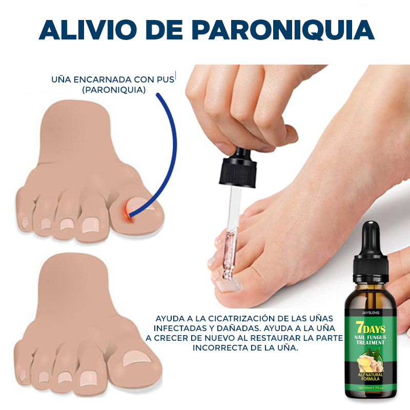 Aceite para el cuidado de pies y manos - NailCare™