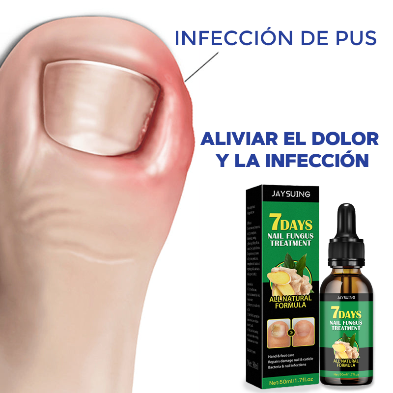 Aceite para el cuidado de pies y manos - NailCare™