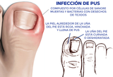 Aceite para el cuidado de pies y manos - NailCare™