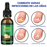 Aceite para el cuidado de pies y manos - NailCare™